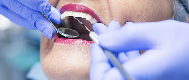 Best Emergency Root Canal Treatment in Shorewood, MN